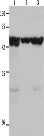 Gel: 10%SDS-PAGE, Lysate: 30 μg, Lane 1-3: Mouse kidney tissue, 293T cells, hela cells, Primary antibody: TRAP1 Antibody(TRAP1 Antibody) at dilution 1/1500, Secondary antibody: Goat anti rabbit IgG at 1/8000 dilution, Exposure time: 20 secondsRabbit anti-Human TRAP1 Polyclonal Antibody