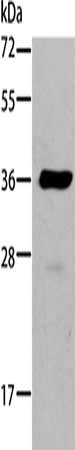 Gel: 10%SDS-PAGE, Lysate: 40 μg, Lane: A549 cells, Primary antibody: AKR1B10 Antibody(AKR1B10 Antibody) at dilution 1/184, Secondary antibody: Goat anti rabbit IgG at 1/8000 dilution, Exposure time: 5 secondsRabbit anti-Human AKR1B10 Polyclonal Antibody
