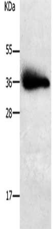 Gel: 10%SDS-PAGE, Lysate: 30 μg, Lane: Human liver cancer tissue, Primary antibody: PPAP2A Antibody(PPAP2A Antibody) at dilution 1/650, Secondary antibody: Goat anti rabbit IgG at 1/8000 dilution, Exposure time: 1 secondRabbit anti-Human PPAP2A Polyclonal Antibody