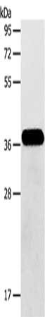 Gel: 10%SDS-PAGE, Lysate: 40 μg, Lane: Human fetal brain tissue, Primary antibody: AASDHPPT Antibody(AASDHPPT Antibody) at dilution 1/600, Secondary antibody: Goat anti rabbit IgG at 1/8000 dilution, Exposure time: 30 seconds