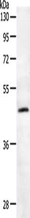 Gel: 10%SDS-PAGE, Lysate: 40 μg, Lane: NIH/3T3 cells, Primary antibody: SPAG4 Antibody(SPAG4 Antibody) at dilution 1/550, Secondary antibody: Goat anti rabbit IgG at 1/8000 dilution, Exposure time: 1 minuteRabbit anti-Human SPAG4 Polyclonal Antibody