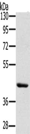 Gel: 8%SDS-PAGE, Lysate: 40 μg, Lane: Skov3 cells, Primary antibody: HSD3B7 Antibody(HSD3B7 Antibody) at dilution 1/400, Secondary antibody: Goat anti rabbit IgG at 1/8000 dilution, Exposure time: 10 secondsRabbit anti-Human HSD3B7 Polyclonal Antibody