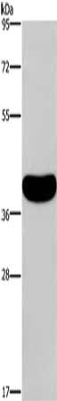 Gel: 8%SDS-PAGE, Lysate: 40 μg, Lane: Human normal colon tissue, Primary antibody: CRELD2 Antibody(CRELD2 Antibody) at dilution 1/550, Secondary antibody: Goat anti rabbit IgG at 1/8000 dilution, Exposure time: 2 minutesRabbit anti-Human CRELD2 Polyclonal Antibody