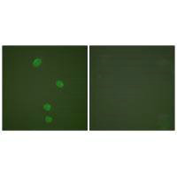 Immunofluorescence analysis of HepG2 cells, using MCM5 antibody.
