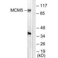 Western blot analysis of extracts from HepG2 cells, using MCM5 antibody.