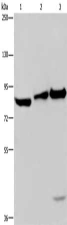 Gel: 6%SDS-PAGE, Lysate: 40 μg, Lane 1-3: NIH/3T3 cells, mouse lung tissue, Mouse liver tissue, Primary antibody: MAPRE3 Antibody(ECE1 Antibody) at dilution 1/550, Secondary antibody: Goat anti rabbit IgG at 1/8000 dilution, Exposure time: 3 seconds