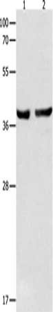 Gel: 12%SDS-PAGE, Lysate: 40 μg, Lane 1-2: Mouse esophagus tissue, human cervical cancer tissue, Primary antibody: SERPINB5 Antibody(SERPINB5 Antibody) at dilution 1/1000, Secondary antibody: Goat anti rabbit IgG at 1/8000 dilution, Exposure time: 13 secondsRabbit anti-Human SERPINB5 Polyclonal Antibody