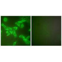 Immunofluorescence analysis of A549 cells, using Stefin B antibody.Rabbit anti-Human CSTB Polyclonal Antibody