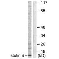 Western blot analysis of extracts from A549 cells, using Stefin B antibody.Rabbit anti-Human CSTB Polyclonal Antibody