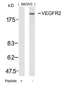 Western blot analysis of extracts from SKOV3 cells using VEGFR2(Ab-951) Antibody and the same antibody preincubated with blocking peptide.