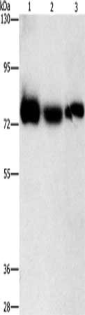 Gel: 8%SDS-PAGE, Lysate: 40 μg, Lane 1-3: Human fetal muscle tissue, K562 cells, hela cells, Primary antibody: AMPD1 Antibody(AMPD1 Antibody) at dilution 1/1600, Secondary antibody: Goat anti rabbit IgG at 1/8000 dilution, Exposure time: 3 secondsRabbit anti-Human AMPD1 Polyclonal Antibody