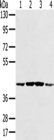 Gel: 8%SDS-PAGE, Lysate: 40 μg, Lane 1-4: Hela cells, K562 cells, Raji cells, Jurkat cells, Primary antibody: PAICS Antibody(PAICS Antibody) at dilution 1/550, Secondary antibody: Goat anti rabbit IgG at 1/8000 dilution, Exposure time: 20 secondsRabbit anti-Human PAICS Polyclonal Antibody