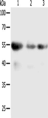 Gel: 10%SDS-PAGE, Lysate: 50 μg, Lane 1-3: SKOV3 cells, A549 cells, human liver cancer tissue, Primary antibody: PRCP Antibody(PRCP Antibody) at dilution 1/100, Secondary antibody: Goat anti rabbit IgG at 1/8000 dilution, Exposure time: 5 minutesRabbit anti-Human PRCP Polyclonal Antibody