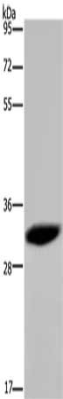 Gel: 8%SDS-PAGE, Lysate: 40 μg, Lane: 231 cells, Primary antibody: HMGN5 Antibody(HMGN5 Antibody) at dilution 1/100, Secondary antibody: Goat anti rabbit IgG at 1/8000 dilution, Exposure time: 5 minutesRabbit anti-Human HMGN5 Polyclonal Antibody