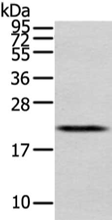 Gel: 12%SDS-PAGE, Lysate: 40 μg, Lane: Human placenta tissue, Primary antibody: MED28 Antibody(MED28 Antibody) at dilution 1/400 dilution, Secondary antibody: Goat anti rabbit IgG at 1/8000 dilution, Exposure time: 30 seconds