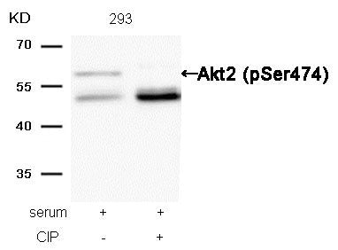 Western blot analysis of extracts from 293 cells, treated with serum or calf intestinal phosphatase (CIP), using Akt2 (Phospho-Ser474)  Antibody.Rabbit anti-Human AKT2 Polyclonal Antibody