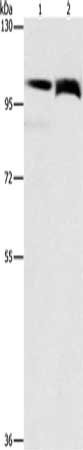 Gel: 6%SDS-PAGE, Lysate: 40 μg, Lane 1-2: Lovo cells, 231 cells, Primary antibody: FLT3 Antibody(FLT3 Antibody) at dilution 1/240, Secondary antibody: Goat anti rabbit IgG at 1/8000 dilution, Exposure time: 15 secondsRabbit anti-Human FLT3 Polyclonal Antibody