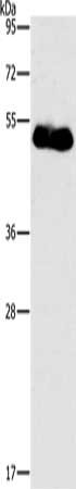 Gel: 8%SDS-PAGE, Lysate: 40 μg, Lane: Human placenta tissue, Primary antibody: FOXF2 Antibody(FOXF2 Antibody) at dilution 1/733, Secondary antibody: Goat anti rabbit IgG at 1/8000 dilution, Exposure time: 5 minutesRabbit anti-Human FOXF2 Polyclonal Antibody