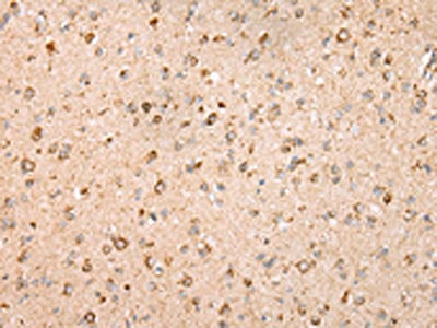 The image on the left is immunohistochemistry of paraffin-embedded Human brain tissue using UQCRC2 Antibody(UQCRC2 Antibody) at dilution 1/25, on the right is treated with fusion protein. (Original magnification: ×200)Rabbit anti-Human UQCRC2 Polyclonal Antibody