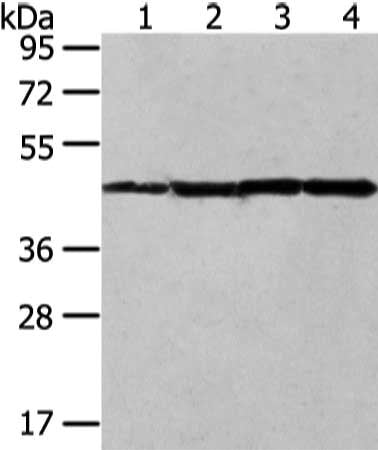 Gel: 8%SDS-PAGE, Lysate: 40 μg, Lane 1-4: Mouse muscle tissue and HT-29 cell, A431 and Jurkat cell, Primary antibody: UQCRC2 Antibody(UQCRC2 Antibody) at dilution 1/400 dilution, Secondary antibody: Goat anti rabbit IgG at 1/8000 dilution, Exposure time: 10 secondsRabbit anti-Human UQCRC2 Polyclonal Antibody