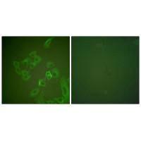 Immunofluorescence analysis of A549 cells, using Synuclein β antibody.Rabbit anti-Human SNCB Polyclonal Antibody