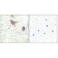 Immunohistochemical analysis of paraffin-embedded human brain tissue using Synuclein β antibody.Rabbit anti-Human SNCB Polyclonal Antibody