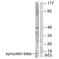 Western blot analysis of extracts from HeLa cells, using Synuclein β antibody.Rabbit anti-Human SNCB Polyclonal Antibody