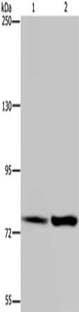 Gel: 6%SDS-PAGE, Lysate: 40 μg, Lane 1-2: Hela cells, K562 cells, Primary antibody: GAB2 Antibody(GAB2 Antibody) at dilution 1/300, Secondary antibody: Goat anti rabbit IgG at 1/8000 dilution, Exposure time: 3 minutesRabbit anti-Human GAB2 Polyclonal Antibody