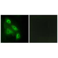 Immunofluorescence analysis of HeLa cells, using ES8L3 antibody.Rabbit anti-Human EPS8L3 Polyclonal Antibody
