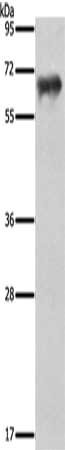 Gel: 10%SDS-PAGE, Lysate: 40 μg, Lane: Human ovarian cancer tissue, Primary antibody: FSHR Antibody(FSHR Antibody) at dilution 1/950, Secondary antibody: Goat anti rabbit IgG at 1/8000 dilution, Exposure time: 40 secondsRabbit anti-Human FSHR Polyclonal Antibody