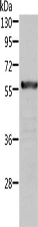 Gel: 10%SDS-PAGE, Lysate: 40 μg, Lane: Rat kidney tissue, Primary antibody: ALDH6A1 Antibody(ALDH6A1 Antibody) at dilution 1/450, Secondary antibody: Goat anti rabbit IgG at 1/8000 dilution, Exposure time: 30 secondsRabbit anti-Human ALDH6A1 Polyclonal Antibody