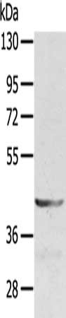 Gel: 8%SDS-PAGE, Lysate: 40 μg, Lane: Jurkat cells, Primary antibody: SDC3 Antibody(SDC3 Antibody) at dilution 1/400, Secondary antibody: Goat anti rabbit IgG at 1/8000 dilution, Exposure time: 2 minutesRabbit anti-Human SDC3 Polyclonal Antibody