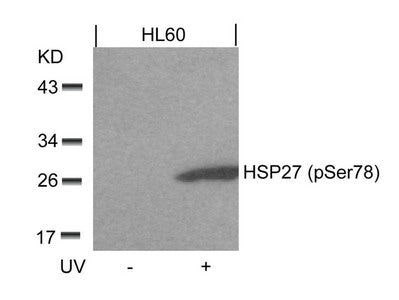 Western blot analysis of extracts from HL60 cells untreated or treated with UV using HSP27(Phospho-Ser78) Antibody.Rabbit anti-Human HSPB1 Polyclonal Antibody