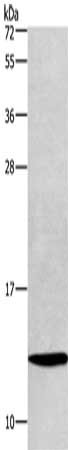 Gel: 10%SDS-PAGE, Lysate: 40 μg, Lane: LoVo cells, Primary antibody: HINT1 Antibody(HINT1 Antibody) at dilution 1/400, Secondary antibody: Goat anti rabbit IgG at 1/8000 dilution, Exposure time: 15 secondsRabbit anti-Human HINT1 Polyclonal Antibody