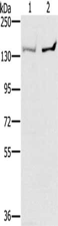 Gel: 6%SDS-PAGE, Lysate: 40 μg, Lane 1-2: 293T cells, PC3 cells, Primary antibody: PPP2R3A Antibody(PPP2R3A Antibody) at dilution 1/400, Secondary antibody: Goat anti rabbit IgG at 1/8000 dilution, Exposure time: 30 secondsRabbit anti-Human PPP2R3A Polyclonal Antibody