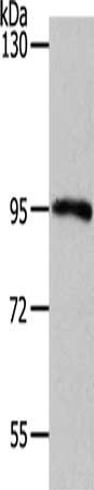 Gel: 8%SDS-PAGE, Lysate: 50 μg, Lane: Mouse kidney tissue, Primary antibody: MYSM1 Antibody(MYSM1 Antibody) at dilution 1/1100, Secondary antibody: Goat anti rabbit IgG at 1/8000 dilution, Exposure time: 40 secondsRabbit anti-Human MYSM1 Polyclonal Antibody
