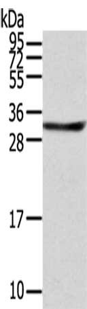Gel: 12%SDS-PAGE,Lysate: 40 μg,,Primary antibody: STX8 Antibody(STX8 Antibody) at dilution 1/800 dilution,Secondary antibody: Goat anti rabbit IgG at 1/8000 dilution,Exposure time: 3 secondsRabbit anti-Human STX8 Polyclonal Antibody