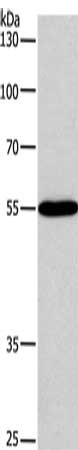 Gel: 8%SDS-PAGE, Lysate: 40 μg, Lane: Raji cells, Primary antibody: BLK Antibody(BLK Antibody) at dilution 1/250, Secondary antibody: Goat anti rabbit IgG at 1/8000 dilution, Exposure time: 20 seconds