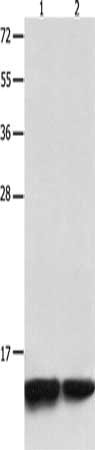 Gel: 12%SDS-PAGE, Lysate: 40 μg, Lane 1-2: Jurkat cells, 231 cells, Primary antibody: MYL9 Antibody(MYL9 Antibody) at dilution 1/1500, Secondary antibody: Goat anti rabbit IgG at 1/8000 dilution, Exposure time: 30 secondsRabbit anti-Human MYL9 Polyclonal Antibody