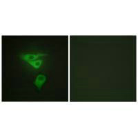 Immunofluorescence analysis of HepG2 cells, using PDLIM1 antibody.Rabbit anti-Human PDLIM1 Polyclonal Antibody