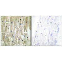 Immunohistochemistry analysis of paraffin-embedded human heart tissue using PDLIM1 antibody.Rabbit anti-Human PDLIM1 Polyclonal Antibody