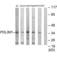 Western blot analysis of extracts from Jurkat cells, COLO205 cells, 293 cells, HepG2 cells and HUVEC cells, using PDLIM1 antibody.Rabbit anti-Human PDLIM1 Polyclonal Antibody