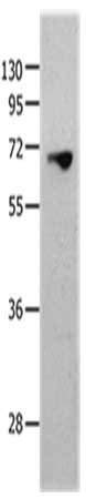 Gel: 10+12%SDS-PAGE, Lysate: 40 μg, Lane: 823 cells, Primary antibody: MMP25 Antibody(MMP25 Antibody) at dilution 1/1300, Secondary antibody: Goat anti rabbit IgG at 1/8000 dilution, Exposure time: 2 minutesRabbit anti-Human MMP25 Polyclonal Antibody
