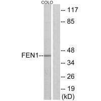 Western blot analysis of extracts from Jurkat cells, 293 cells and HUVEC cells, using FEN1 antibody.Rabbit anti-Human FEN1 Polyclonal Antibody