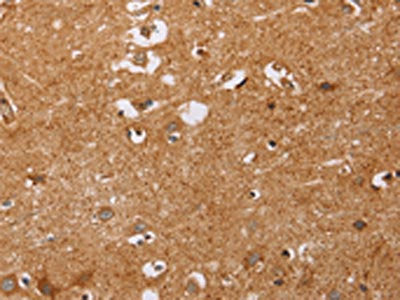 The image on the left is immunohistochemistry of paraffin-embedded Human brain  tissue using CD38 Antibody(CD38 Antibody) at dilution 1/60, on the right is treated with synthetic peptide. (Original magnification: ×200)Rabbit anti-Human CD38 Polyclonal Antibody