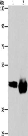 Gel: 6%SDS-PAGE, Lysate: 40 μg, Lane 1-2: A549 cells, Raji cells, Primary antibody: CD38 Antibody(CD38 Antibody) at dilution 1/520, Secondary antibody: Goat anti rabbit IgG at 1/8000 dilution, Exposure time: 3 minutesRabbit anti-Human CD38 Polyclonal Antibody