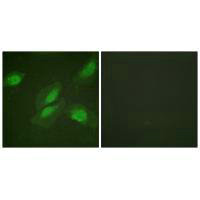 Immunofluorescence analysis of HeLa cells, using Akt (Ab-326) antibody.Rabbit anti-Human AKT1 Polyclonal Antibody