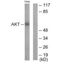 Western blot analysis of extracts from NIH/3T3 cells, treated with Insulin (0.01U/ml, 15mins), using Akt (Ab-326) antibody.Rabbit anti-Human AKT1 Polyclonal Antibody