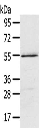 Gel: 8%SDS-PAGE,Lysate: 40 μg,,Primary antibody: ISM2 Antibody(ISM2 Antibody) at dilution 1/300 dilution,Secondary antibody: Goat anti rabbit IgG at 1/8000 dilution,Exposure time: 1 minute