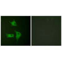 Immunofluorescence analysis of HeLa cells, using p15 INK antibody.Rabbit anti-Human CDKN2B Polyclonal Antibody